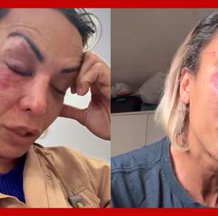 Ativista trans Iza Potter é agredida por homem no prédio em que mora em SP: 'Estou com muito medo'