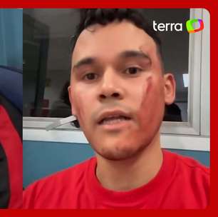 Torcedor do São Paulo atingido por placa no Morumbis relata situação: 'Precisei invadir o campo'