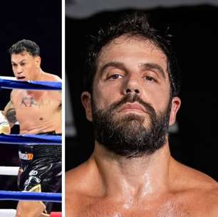 Duda Nagle mostra hematomas no rosto após levar surra de Popó