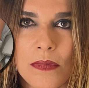 Atriz Mara Carvalho é atropelada por manobrista do carro dela na saída de restaurante
