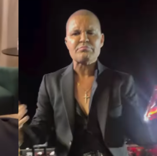 Eduardo Costa revela motivo inusitado da queda de seu cabelo: 'Usei muita'