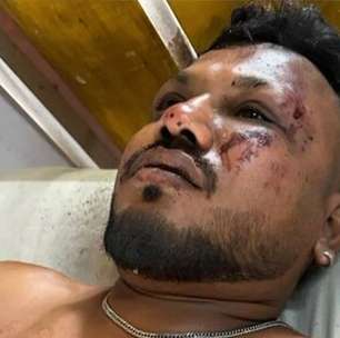 Homem diz ter saído andando de avião após queda na Índia: "Tudo foi muito rápido"