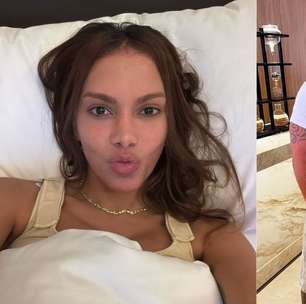 O que Anitta fez no rosto? Veja todos os procedimentos