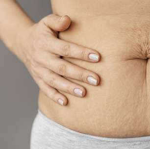 Canetas emagrecedoras: dicas para evitar a flacidez na pele