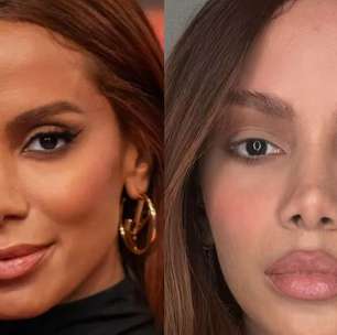 Lifting endoscópio e lifting labial: cirurgião plástico lista 4 indícios de que Anitta passou pelos 2 procedimentos estéticos