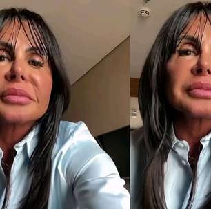 Gretchen revela diagnóstico sério após desistir de reality show