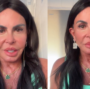 Gretchen passa por mais uma harmonização facial e apresenta novo rosto
