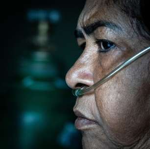 Estudo desvenda relação entre vírus da Covid-19 e trombose