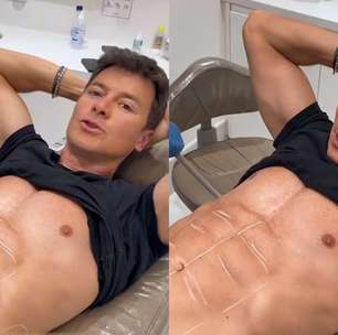 Rodrigo Faro detalha procedimento na barriga para reduzir gordura: 'Meio flácido'