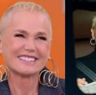 Antes e depois surpreendente: Xuxa impressiona em cinco meses após transplante capilar