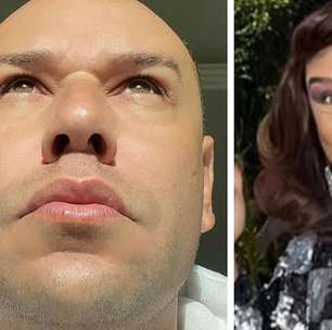 Tiago Barnabé, a Narcisa, revela procedimento estético e declara: 'Muda por completo'