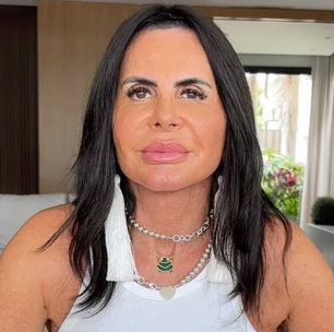 Gretchen revela uso da cannabis medicinal e explica motivo