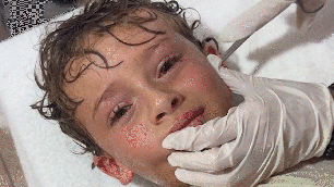 Caranguejo é retirado de ouvido de criança após ida à praia: 'Novo medo desbloqueado'