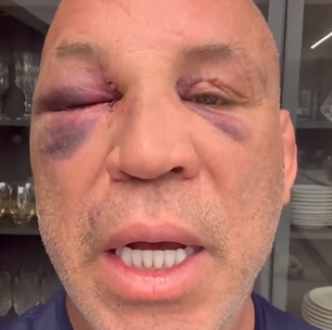 Wanderlei Silva diz que 'memória está voltando' após sair desacordado de confusão com equipe de Popó