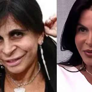 Gretchen detona quem fala sobre sua aparência