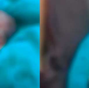 Bebê encontrado vivo durante velório no Acre morre após ficar 12 horas dentro de um saco