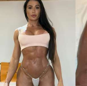 Gracyanne Barbosa mostra o corpo após lesão e cirurgia no Dança dos Famosos