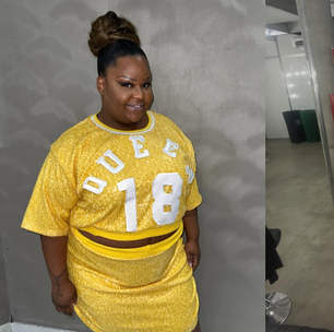 MC Carol mostra resultado de lipo na papada após perder 60 kg; veja antes e depois