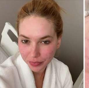 Virgínia desmente boatos de cirurgia no rosto e afirma: 'Foi só laser mesmo'