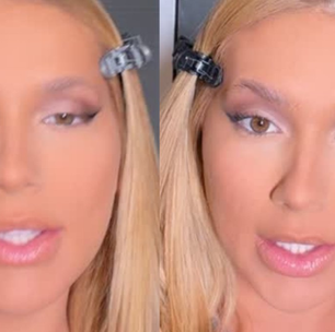 Especialista fala sobre os novos procedimentos que Virginia fez no rosto