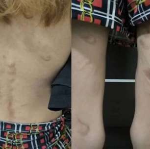 Trisal é detido por tortura e cárcere de adolescente de 16 anos em Goiânia