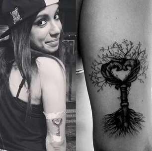 Anitta toma atitude radical e especialista alerta: 'Exige cuidado'