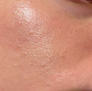 Pele oleosa? Dermatologista diz como deve ser rotina de skincare