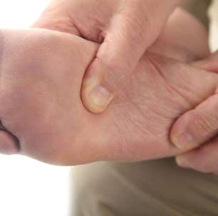 Pisando certo: como tratar o pé chato sem cirurgia