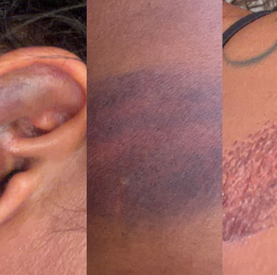 PMs são afastados após denúncia de agressão contra advogada durante festa no RN