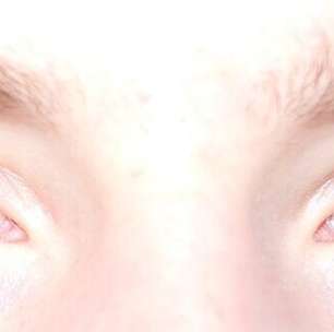 Heterocromia: causas, tipos e curiosidades sobre a diferença de cor nos olhos