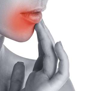 Afta: por que surge, como prevenir e o que fazer para aliviar mais rápido