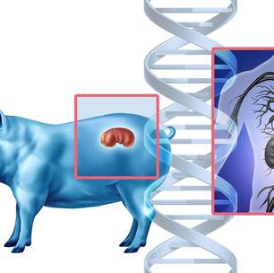 Por que colocar órgãos de porcos em pessoas é aceitável, mas cultivar órgãos humanos em porcos não é?