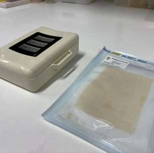 Inovação brasileira pode evitar amputação de pacientes com diabetes