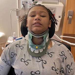 Adolescente de 16 anos fica tetraplégica em acidente com cama elástica em parque