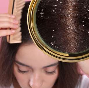 Esqueça a caspa no verão: é verdade que lavar o cabelo todo dia piora a doença? Veja o que dizem especialistas!