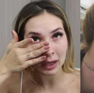 Virginia assusta fãs ao surgir com rosto em carne viva: 'Vai ficar assim agora'