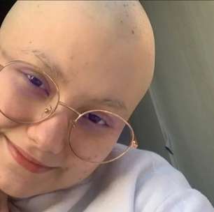 Linfoma de Hodgkin: um câncer do sistema linfático com tratamento eficaz