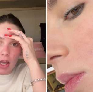 Permanente? Virginia mostra como está rosto queimado após procedimento: 'Pior':