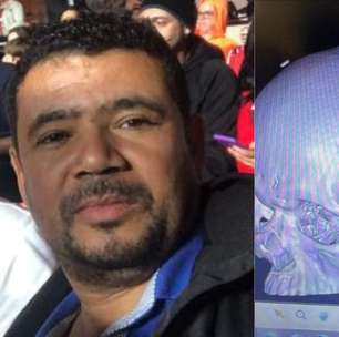 São Paulo e Conmebol terão de pagar pensão de R$ 8 mil a torcedor atingido por placa no estádio