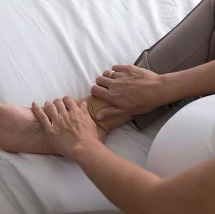 Calor agrava insuficiência venosa e acende alerta no verão