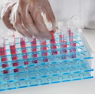 Escovas técnicas mantêm higienização eficiente de vidrarias em laboratórios