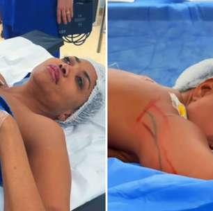 Após secar, Gaby Amarantos faz cirurgia às vésperas do Natal: 'Processo íntimo'