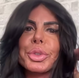 Por que Gretchen perdeu todo o cabelo? Cantora explica problema