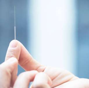 Acupuntura ajuda idosos com dor lombar crônica