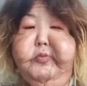 Juju do Pix mostra recuperação após cirurgia no rosto e rebate críticas: 'Um corpo é um corpo'