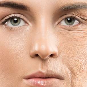 4 truques para evitar o envelhecimento rápido da sua pele