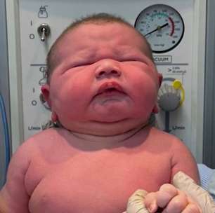 Bebê gigante de quase 13 libras surpreende médicos