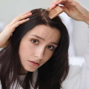 A caspa apareceu? Como tratar a dermatite seborreica