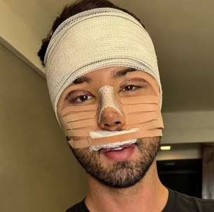 Encurtar as pernas, implantar terceiro seio, mudar região íntima: a obsessão dos famosos pelo corpo