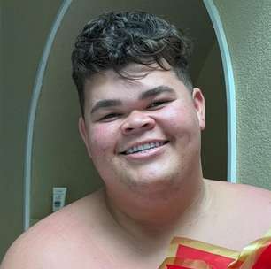 Gordão da XJ passará por cirurgia após perder 130 kg: 'Estou com medo'